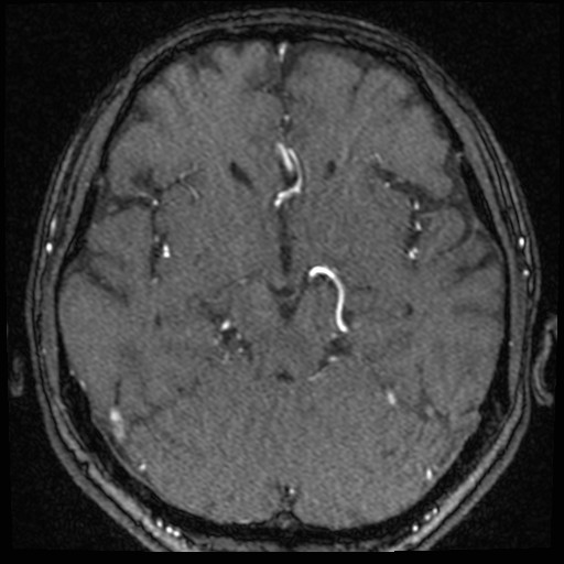 Click on the Serie image to view the images of VILLANUEVA, WILLIAM A.